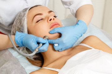 What is skin microdermabrasion?