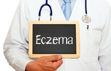 What is eczema?